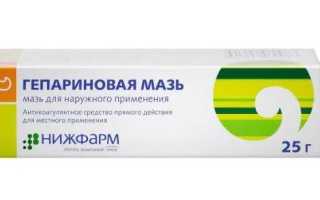 Причины жжения после гепариновой мази