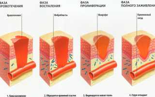 Грануляция кожи
