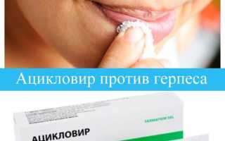 Ацикловир против герпеса
