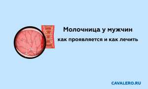 Как проявляется и выглядит молочница у мужчин. Чем эффективно лечить молочницу