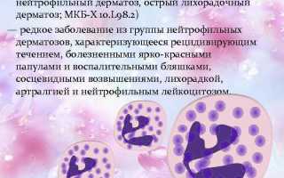 Синдром Свита