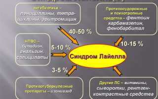 Синдром Лайелла