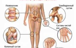 Чем опасен полиартрит ног и как его лечить?