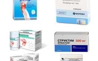 Хондропротекторы для суставов: правда и анализ препаратов