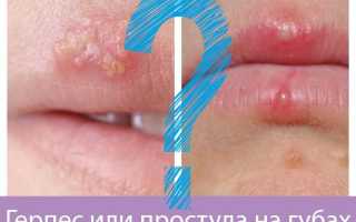 Герпес на губе и простуда на губе одно ли и тоже