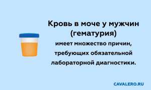 Гематуря — наличие крови в моче. Что это такое, причины появления и способы лечения у мужчин