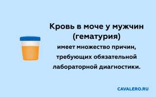 Гематуря — наличие крови в моче. Что это такое, причины появления и способы лечения у мужчин