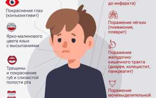 Симптомы коронавируса у детей (COVID-19)