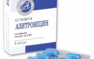 Антибиотики при артритах: как принимать азитромицин
