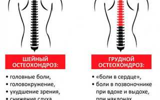 Симптомы и лечение грудного остеохондроза позвоночника