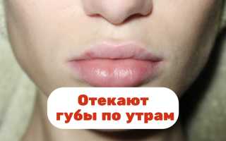 Отекают губы по утрам