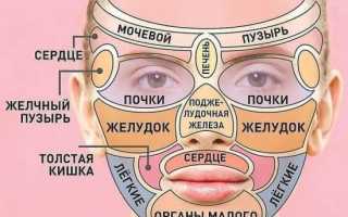 Карта прыщей на лице у мужчин и женщин