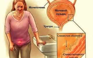 Жжение в уретре у мужчин и женщин