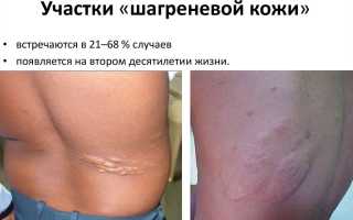 Что такое шагреневая кожа