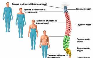 Ушиб позвоночника: как понять тяжесть травмы и лечиться