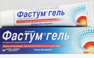 Эффективное лечение артрита коленного сустава: традиционное и народное