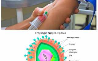 Анализ на герпес