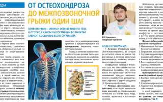 Опасные симптомы остеохондроза — что делать?