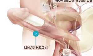 Эректильная дисфункция у мужчин: методы решения проблемы