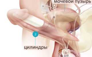 Эректильная дисфункция у мужчин: методы решения проблемы