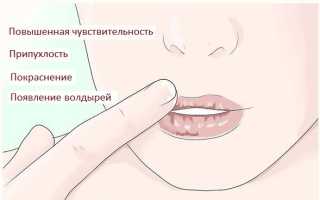 Чем лечить солнечный ожог губ