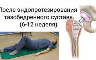 Эндопротезирование тазобедренного сустава, реабилитация
