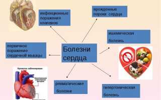 Эфи сердца процедура проведения