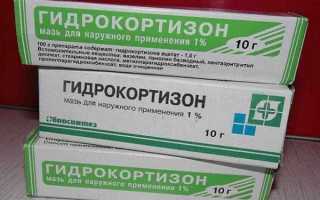 От чего помогает мазь гидрокортизон