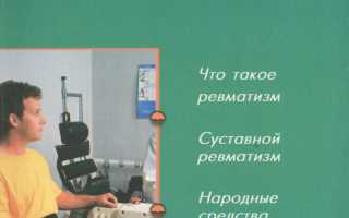 Действенное лечение ревматизма: от традиционной и до народной медицины