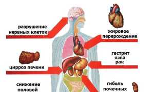 Воздействие алкоголизма на здоровье мужчин