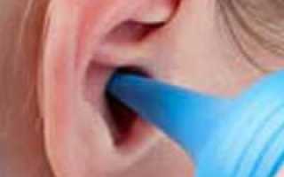 Причины появления серы в ушах. Почему опасно ее удалять ватными палочками