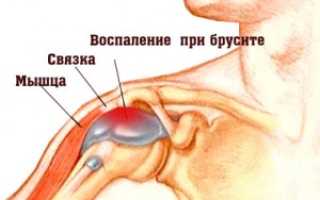 Диклофенак и антибиотик при бурсите