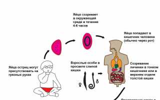 Острицы зуд в заднем проходе