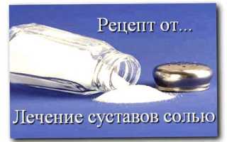 Лечение артроза с помощью соли и снега