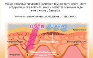 Заболевания меланина