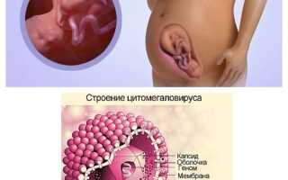 Цитомегаловирус igg положительный при беременности