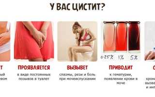 Жжение при цистите у женщин
