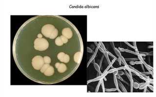 Зуд и дрожжевая инфекция Candida albicans