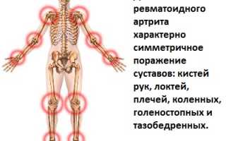 Активность и ремиссия ревматоидного артрита