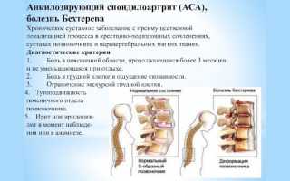 Спондилит — симптомы и лечение позвоночника. Классификация недуга