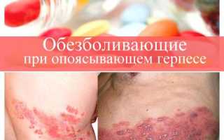 Обезболивающие при опоясывающем герпесе