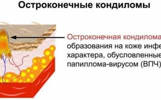 Зуд головки полового члена