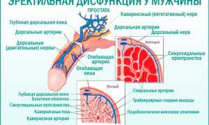 Причины и симптомы эректильной дисфункции