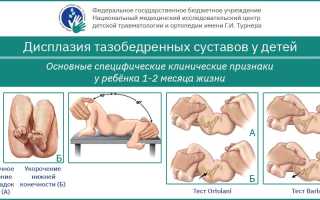 Дисплазия тазобедренных суставов: факты о диагнозе и лечении