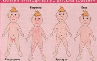Высыпания на теле у ребенка