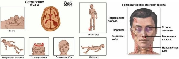 Потеряла сознание