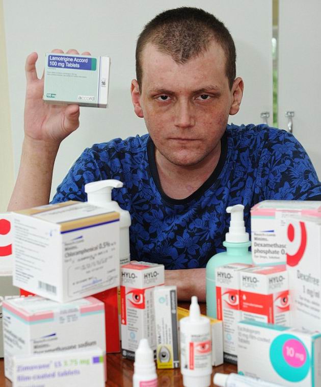 Синдром Стивенса-Джонсона