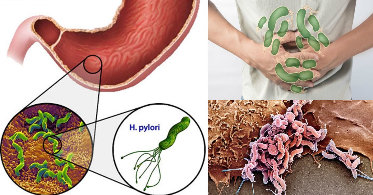 Бактерия Helicobacter pylori