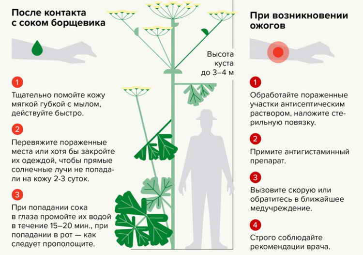 Борщевик Сосновского: первая помощь при ожоге