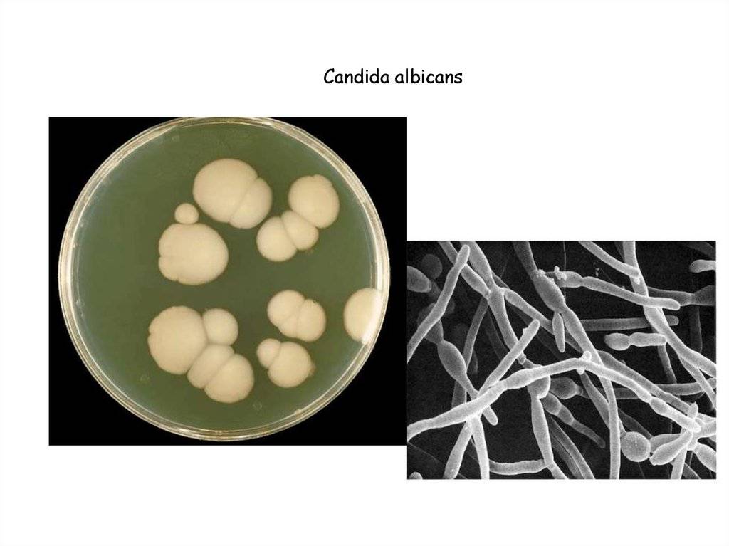 Candida albicans